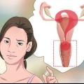 Diagnosi di secrezione vaginale