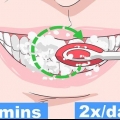 Impedire che una carie nei tuoi denti peggiori