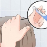 Tratta l'acne sul cuoio capelluto