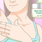 Come sbarazzarsi di bolle causate cicatrici