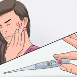 Trattare l'alveolite
