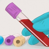 Aumento della velocità di filtrazione glomerulare