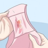 Riconoscere i sintomi della clamidia (per le donne)