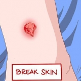 Riconoscere i sintomi di un'infezione da mrsa