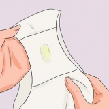 Riconoscere i sintomi del trichomonas nelle donne