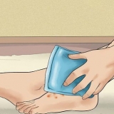 Trattamento dell'eczema disidrotico