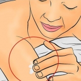 Trattare l'eczema