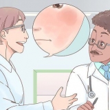 Trattare l'eczema sul viso