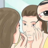 Riconoscere una ciste sulla palpebra