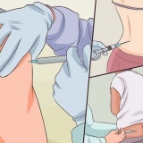 Fare un'iniezione senza provare dolore