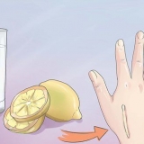 Rimozione di una cicatrice cheloide: si può fare con rimedi da banco?
