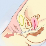 Rimuovere un preservativo sloggiato dal tuo corpo
