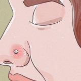 Trattare un piercing al naso infiammato