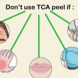 Applicazione di un peeling tca
