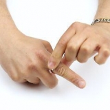 Rimozione di un anello bloccato