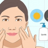 Prevenire la pelle grassa