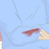 Medicazione di una ferita durante il primo soccorso