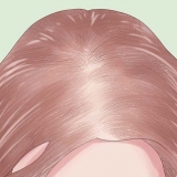 Prevenire la caduta dei capelli a causa dello stress