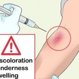 Riconosci quando una delle tue arterie è crollata