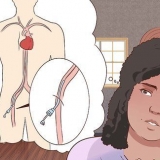 Recupero da un'angiografia
