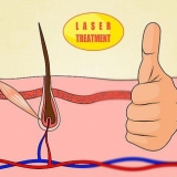 Ottenere il massimo dall'epilazione laser
