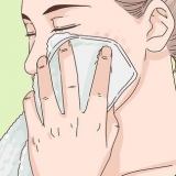Come sbarazzarsi di un brufolo scoppiato in una notte