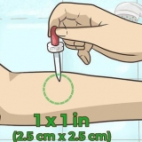 Sbiancamento dei peli del corpo