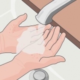Prevenire le cicatrici