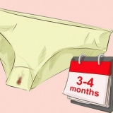 Prevenire il sanguinamento da rottura con la contraccezione