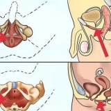 Fai esercizi per i muscoli del pavimento pelvico