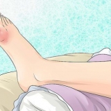 Alleviare il dolore della gotta a casa