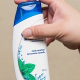 Prevenire e curare la forfora