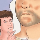 Trattamento dell'eczema seborroico sul viso