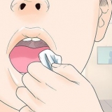Dormire dopo la rimozione del dente del giudizio