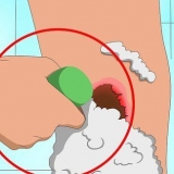 Sbarazzati rapidamente delle croste dell'acne