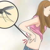 Alleviare il dolore muscolare di chikungunya