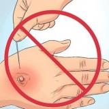 Cure bolle: si può fare naturalmente?