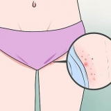 Riconoscere i sintomi del cancro alle labbra