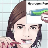 Sbiancamento dei denti con perossido di idrogeno