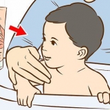 Trattare un'eruzione cutanea sul collo del tuo bambino