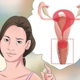 Diagnosi di secrezione vaginale
