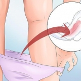 Prevenire il sanguinamento vaginale durante la gravidanza