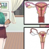Trattare le cisti vaginali