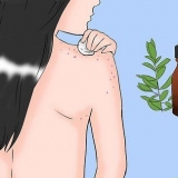 Sbarazzati dell'acne sul tuo corpo