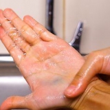 Rimuovi il colorante alimentare dalla pelle