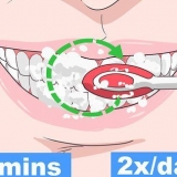 Impedire che una carie nei tuoi denti peggiori