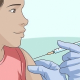 Prevenire la varicella