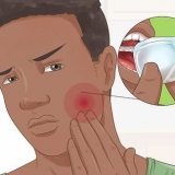 Sapere quando è necessario sostituire le otturazioni dentali