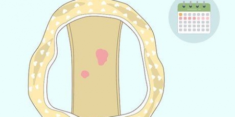 Riconoscere il sanguinamento anormale tra i periodi mestruali