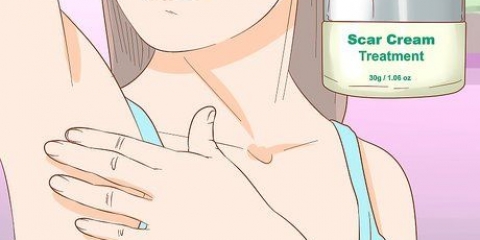 Come sbarazzarsi di bolle causate cicatrici